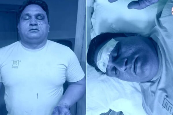 दिल्ली: बेखौफ बदमाशों का पुलिस टीम पर जानलेवा हमला, चाकूबाजी में ASI समेत दो पुलिसकर्मी घायल