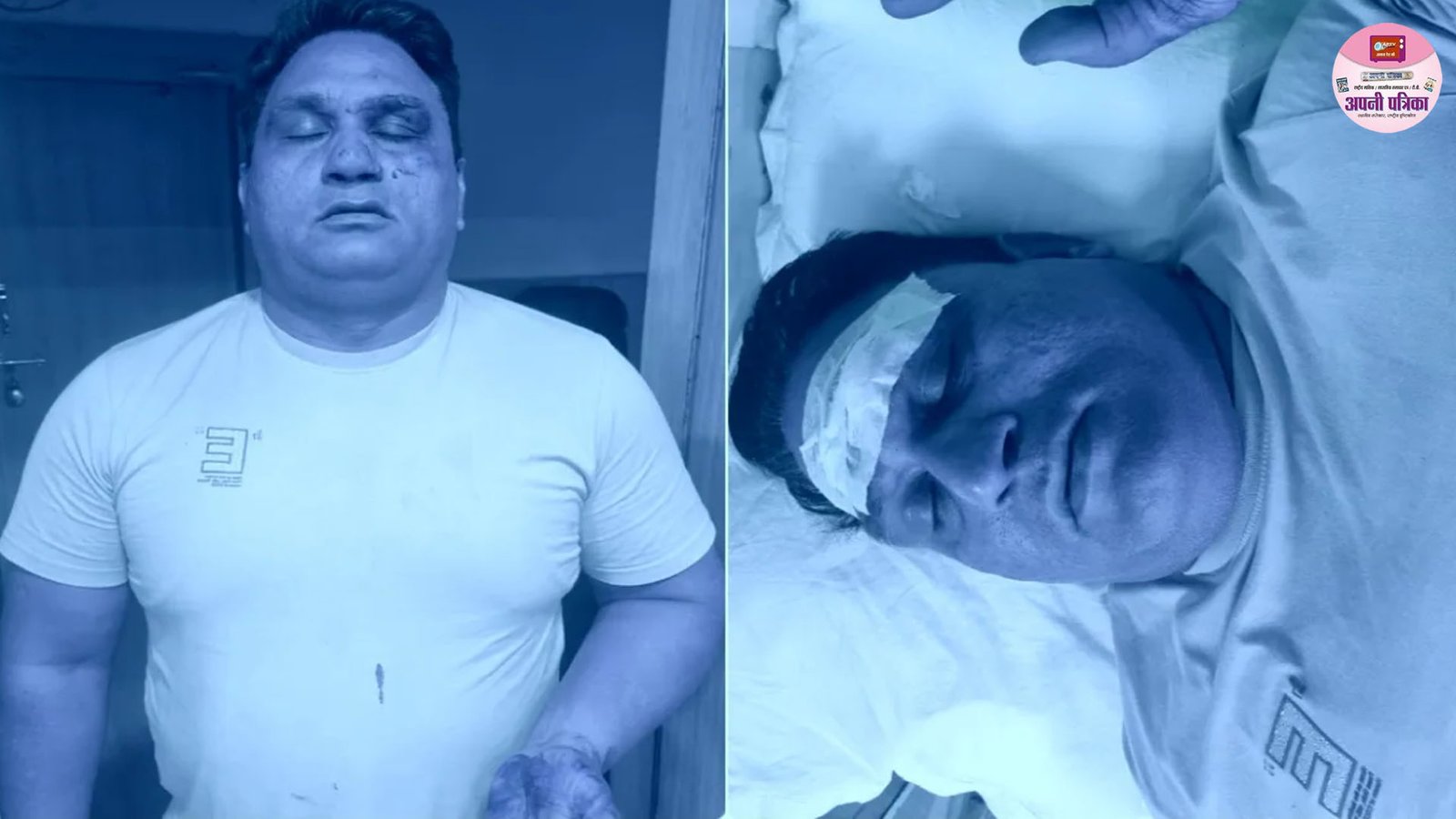 दिल्ली: बेखौफ बदमाशों का पुलिस टीम पर जानलेवा हमला, चाकूबाजी में ASI समेत दो पुलिसकर्मी घायल